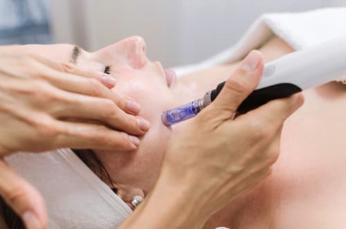 Tratamiento facial indiba en Santiago